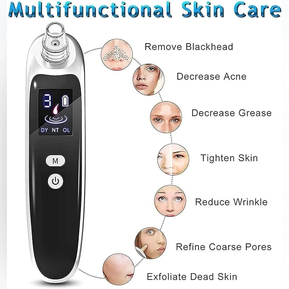 Electric Blackhead Remover Vacuum NEW IN BOX – IHFMPFKJ